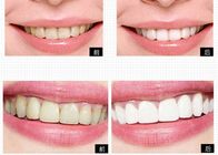 Ιδιωτικό σύστημα λεύκανσης δοντιών προϊόντων προσωπικής φροντίδας λογότυπων για τη λεύκανση εγχώριων δοντιών